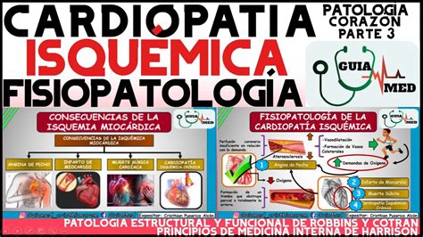 CardiopatÍa IsquÉmica FisiopatologÍa Guiamed Youtube