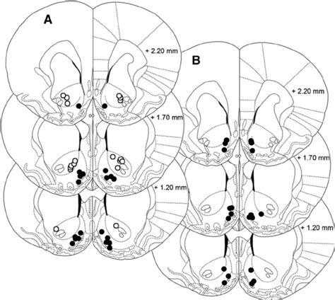 A B Assessment Of Cannulae Placement Schematic Drawing Of Coronal