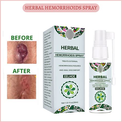 Best Selling And Very Effective Herbal Hemorrhoids Spray 30ml Herbal