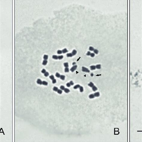 Mitotic Chromosomes Of Arachis Species A A Hermannii B A Rigonii