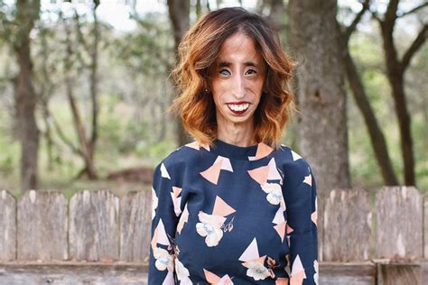 Redirecting Bullying To Empowerment Motivational Speaker And Author Lizzie Velasquez