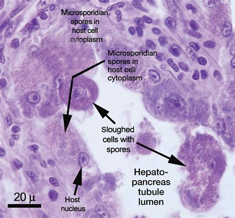 Microsporidian Impacts Shrimp Production Responsible Seafood Advocate