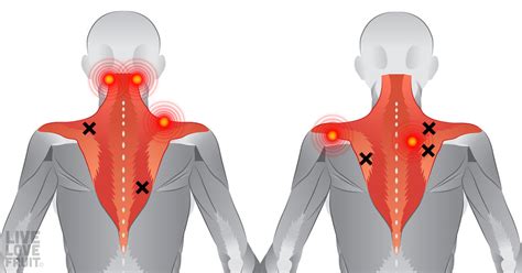 Exercise For Neck And Shoulder Pain Relief - Infoupdate.org