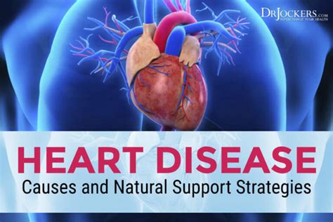 Heart Disease Major Causes And Natural Support Strategies