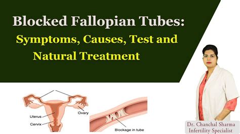 Fallopian Tubes Blockage Symptoms Causes Diagnosis And Natural