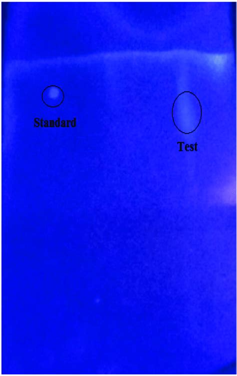 Tlc Plate Developed Under Uv Light At 254 Nm Tlc Thin Layer Download Scientific Diagram