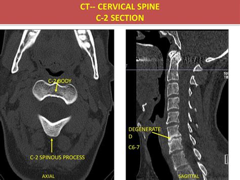 What Are The Indications For MRI CT Online Presentation