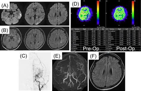 Pre And Postoperative Examinations In Case 2 A Preoperative