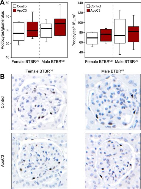 Reversal Of Hypertriglyceridemia In Diabetic Btbr Ob Ob Mice Does Not