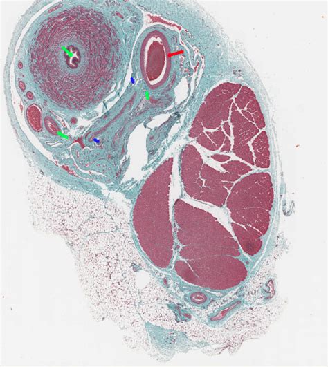 AHS1 Spermatic cord histology Diagram | Quizlet