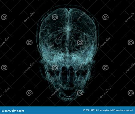 Human Skull Brain By Ct Scan X Ray Visualization Inside Of Skull Stock Illustration