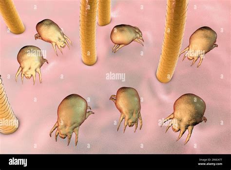 Dust Mites Dermatophagoides Pteronyssinus On Human Skin Computer