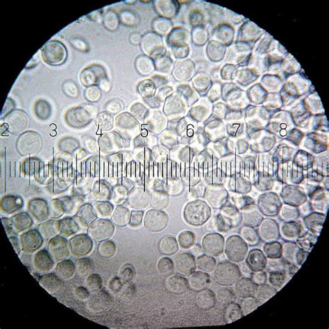 Saccharomyces Cerevisiae The Yeast Commonly Used As Baker S Yeast