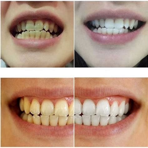 Ml Magic Natural Teeth Whitening Powder Pearl Tooth Brushing Powder