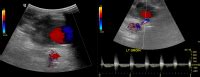 Sonography Vascular Peripheral Arterial Assessment Protocols And