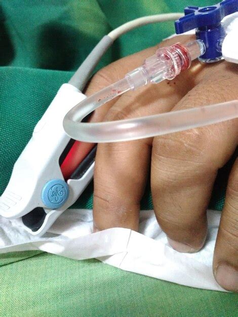 Premium Photo Cropped Image Of Person Hand With Iv Drip In Hospital