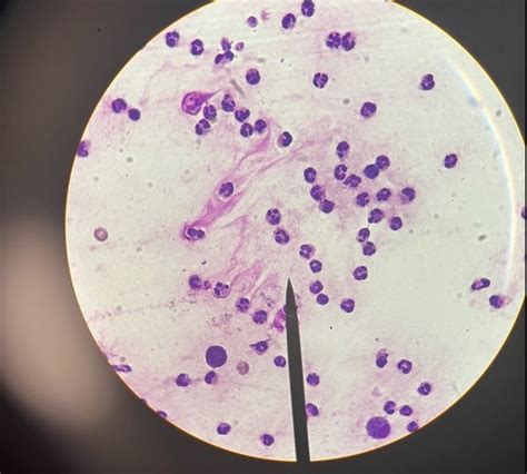 VET 215 Cellular Reactions Flashcards Quizlet