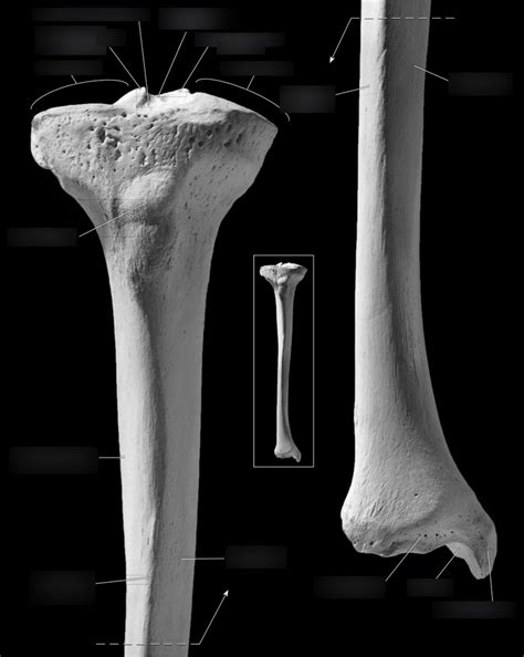 diagram   tibia anterior quizlet