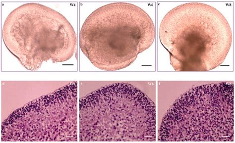 Cells Free Full Text Aberrant Hipscs Derived From Human