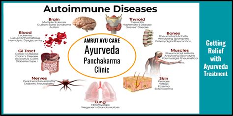 According To Ayurveda Autoimmune Diseases Are For