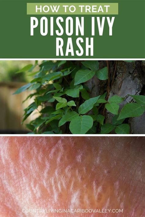 Homemade Poison Ivy Killer Recipe Get Rid Of Poison Ivy Plants