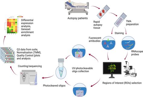 Biomarker Discovery Makes Early Detection Of High Risk Covid