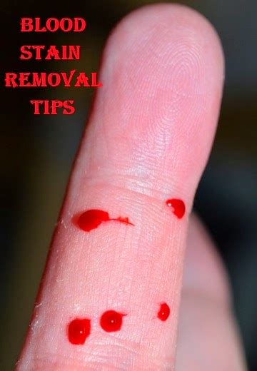 Easy DIY: Blood Stain Removal Tips