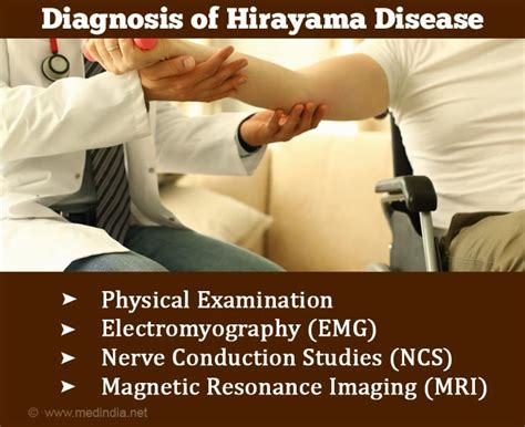 Diagnosis and Treatment of Hirayama Disease