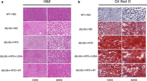 Effects Of Liraglutide On Hepatic Steatosis By Staining With H E A Or