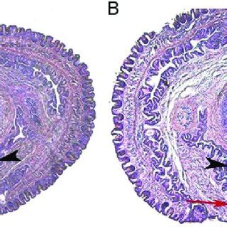 Female External Genitalia By Sem N Confusa Sp N A