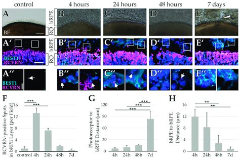 Cocultures Of Retinal Organoids Ro With Byproduct Rpe Brpe In