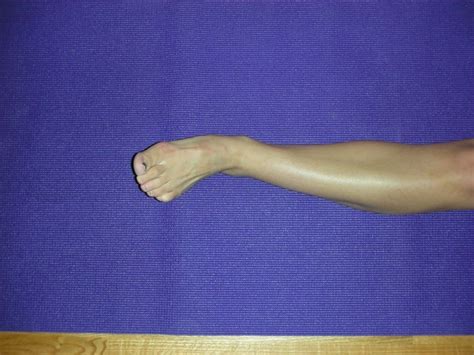 Range Of Motion Exercises After Ankle Injury Eversion Ankle Injury