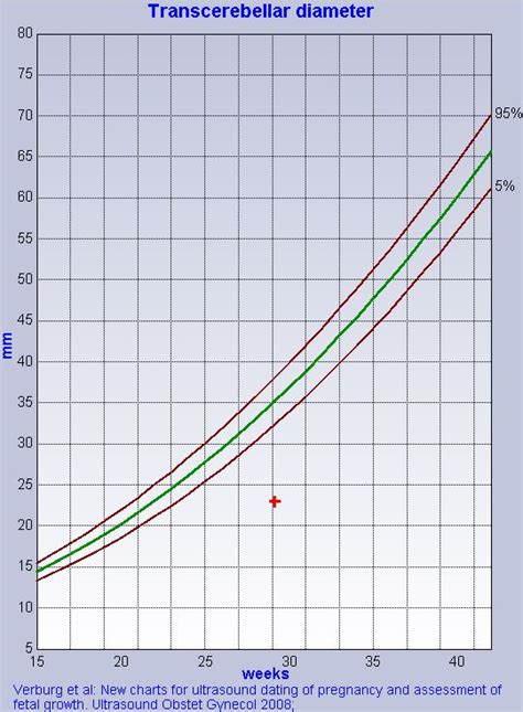 New Charts For Ultrasound Dating Of Pregnancy Telegraph