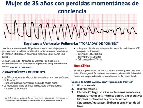 Taquicardia Ventricular Sin Pulso