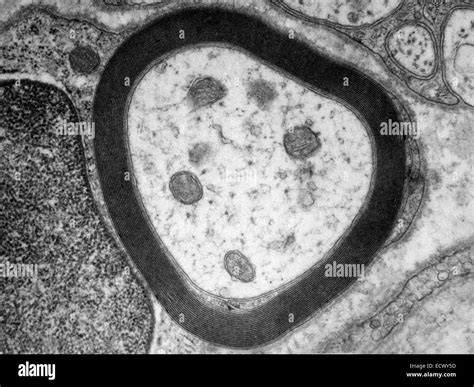 Myelin Sheath Histology