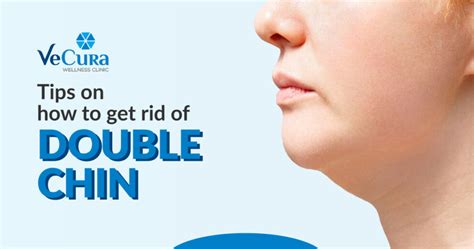 Tips On How To Get Rid Of Double Chin Vecura Wellness