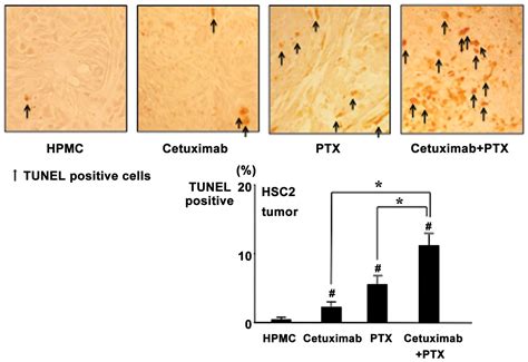 Paclitaxel In Combination With Cetuximab Exerts Antitumor Effect By