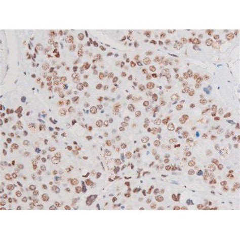 Phospho Limk Ser Polyclonal Antibody Invitrogen L