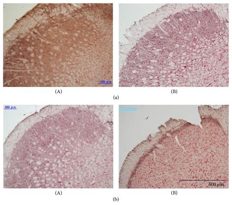 Neural Mechanisms That Underlie Angina Induced Referred Pain In The