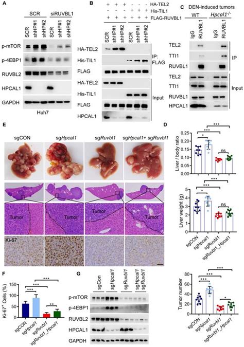 Hippocalcin Like 1 Blunts Liver Lipid Metabolism To Suppress Tumorigenesis Via Directly