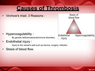 thrombosis.pptx