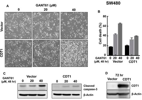 Cdt1 Overexpression In Sw480 Cells And Treatment With Gant61 Were Download Scientific Diagram