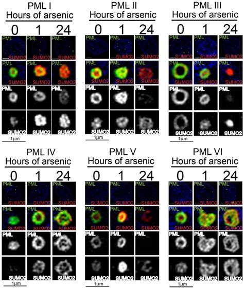 Pml Isoforms In Response To Arsenic High Resolution Analysis Of Pml