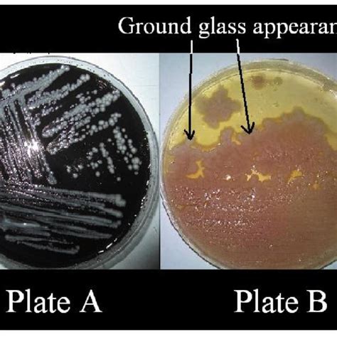 Figure1. Culture plate showing the Legionella pneumophila growth on the ...