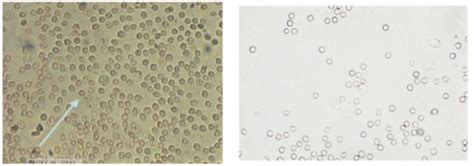 Urinalysis- Microscopic evaluation ch. 29 Flashcards | Quizlet