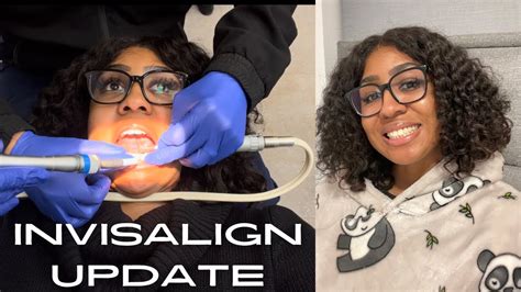 Invisalign Month Update Filing Teeth Pain Level Is Invisalign