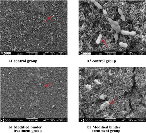 Scanning Electron Microscope SEM Images Of Streptococcus Mutans