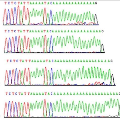 Addition And Deletion Pcr Product Length By Polymerase Slippage