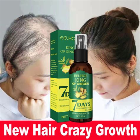 Eelhoe hair growth Essence oil original spray natural sevich herbal ...