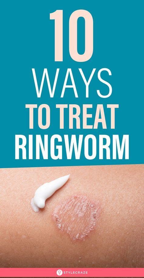 Ring Get Fungal Infection Ringworm In Dogs Treatment